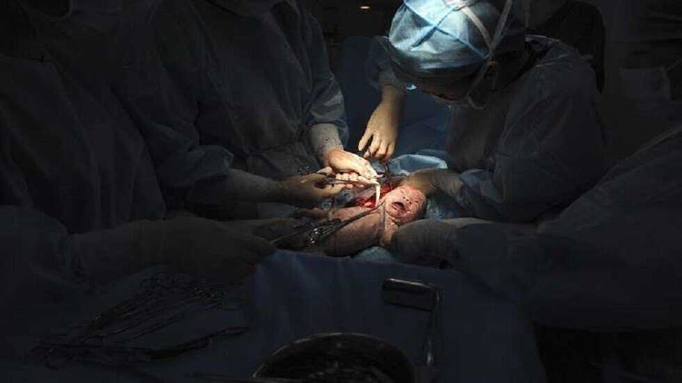 5d838de642360465fd251ce4 كيف تؤثر الولادة القيصرية على مناعة الأطفال؟