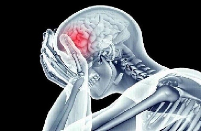 6756b4044c59b74bc252bfef طريقة بسيطة لكشف الإصابة بجلطة دماغية